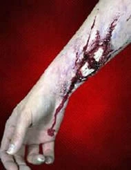 Woochie - Broken Bone Prosthetic